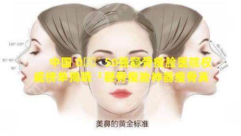 中国 🌴 50强颧骨瘦脸医院权威榜单揭晓「颧骨瘦脸神器瘦骨真的有用么」